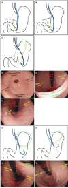 Figure 20
