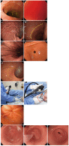 Figure 18