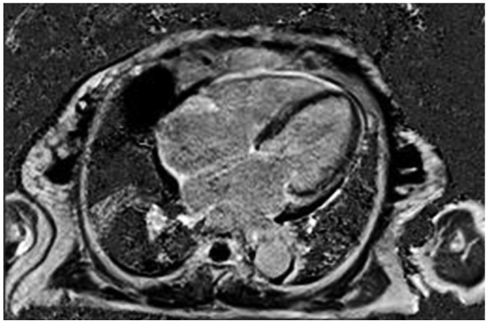 Fig. 4