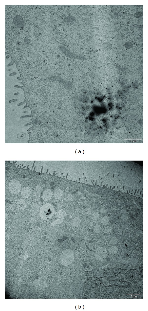 Effect of Nanoparticles and Environmental Particles on a Cocultures ...