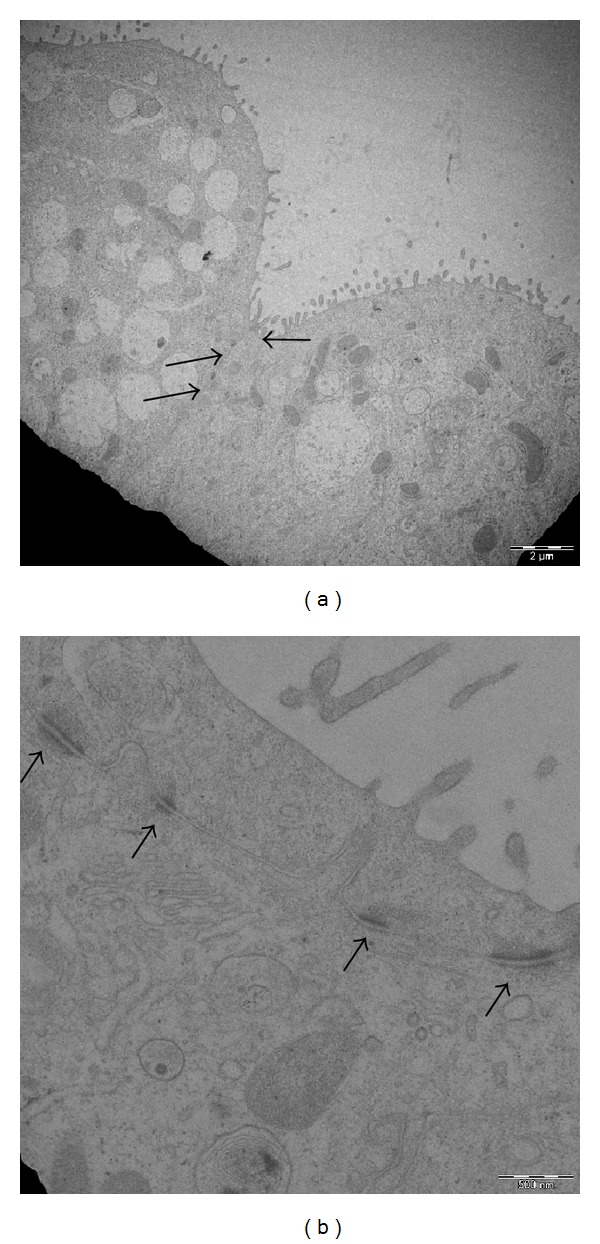 Effect of Nanoparticles and Environmental Particles on a Cocultures ...