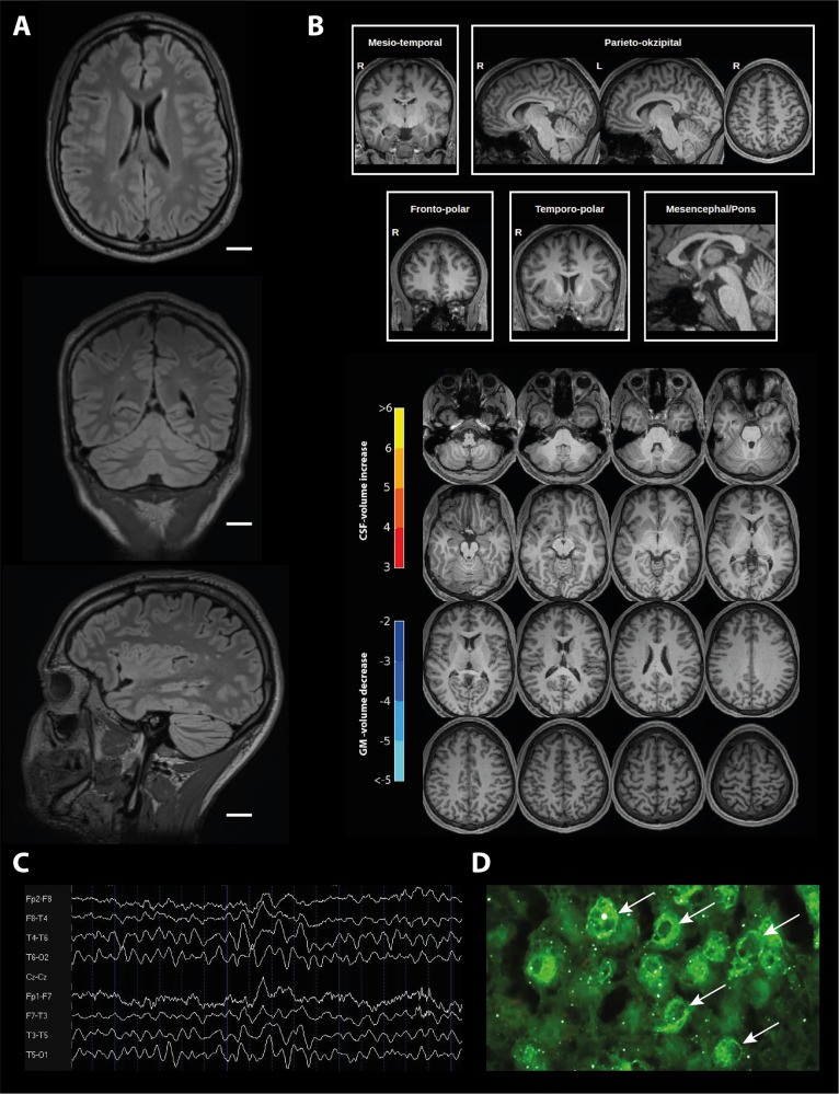 Fig. 3