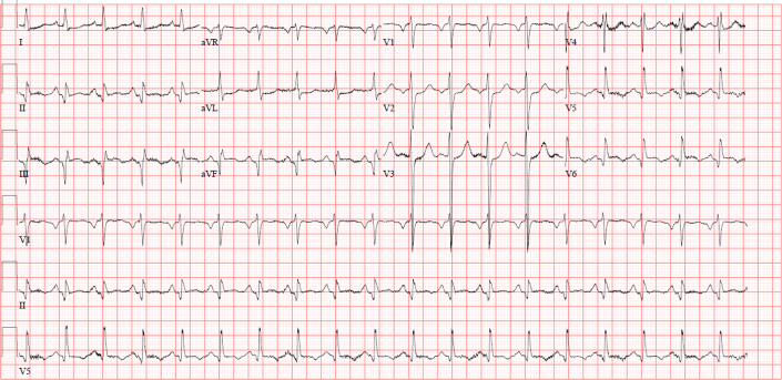 Figure 1