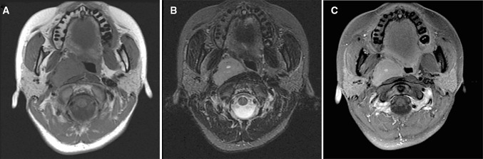 Fig. 1