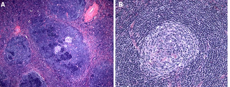 Fig. 2