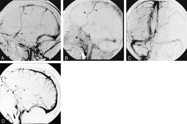 Fig 6.