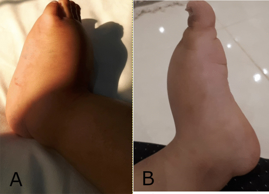 Fig. 4
