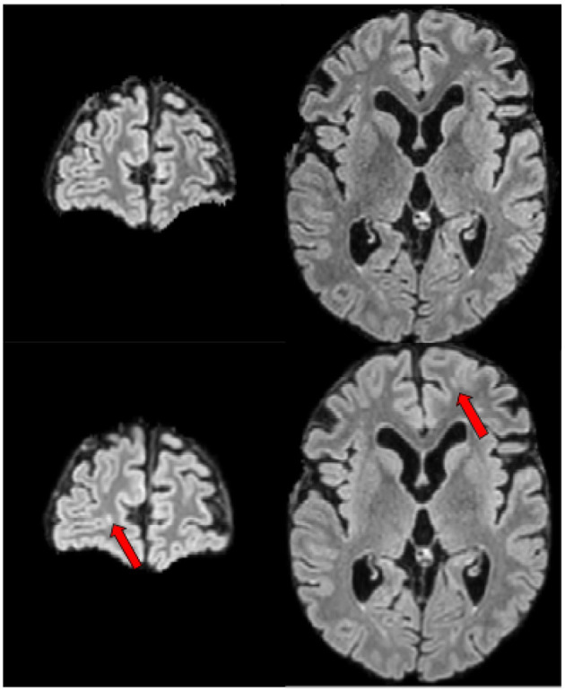 Figure 6