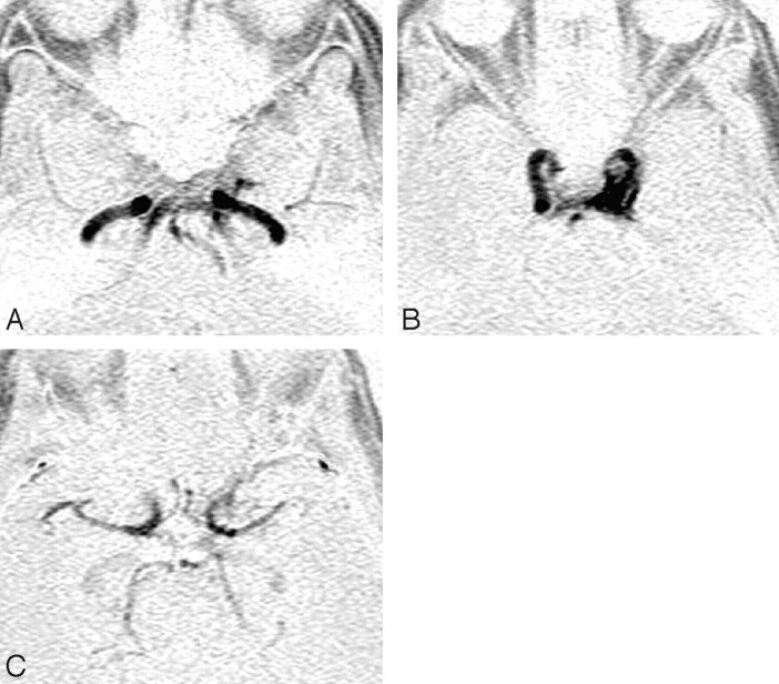 Fig 2.