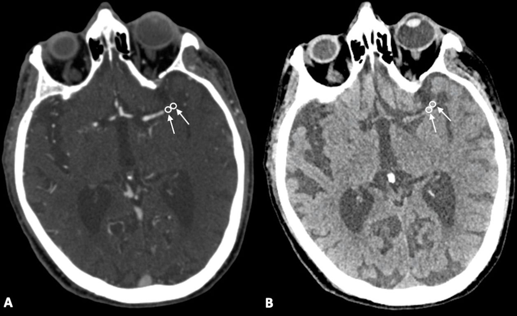 Fig. 2: