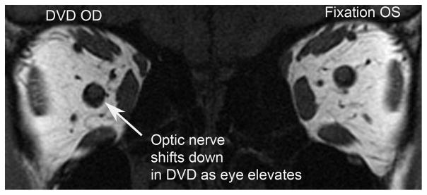 FIG 1