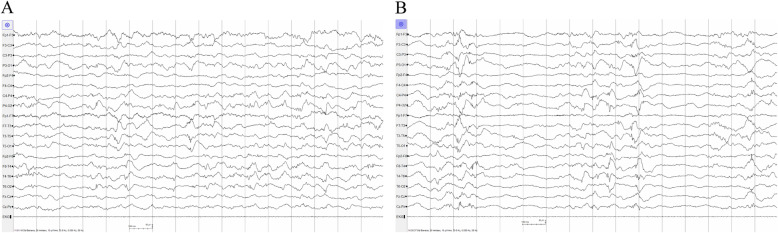 Fig. 2