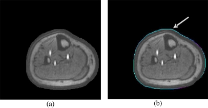 Fig 6