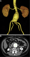 Fig 1
