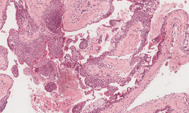 Fig. 4