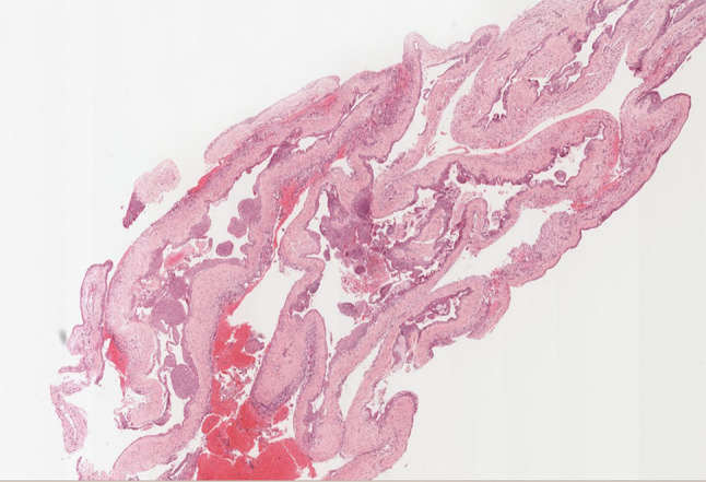 Fig. 3