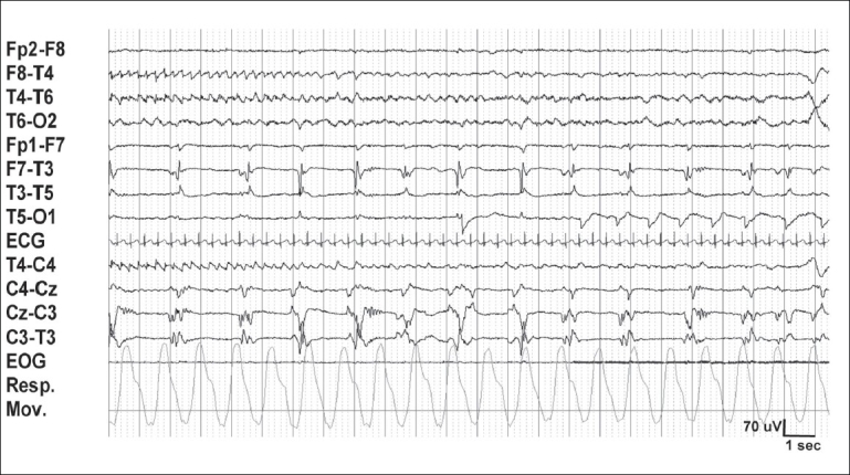 Figure 9