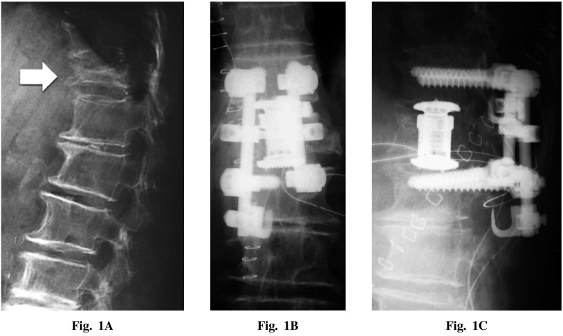 Fig. 1