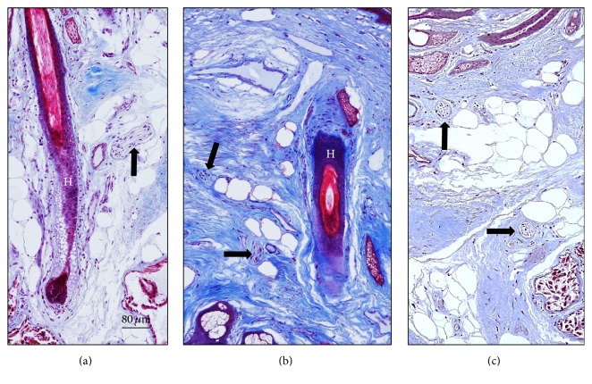 Innervation of the Human Cavum Conchae and Auditory Canal: Anatomical ...