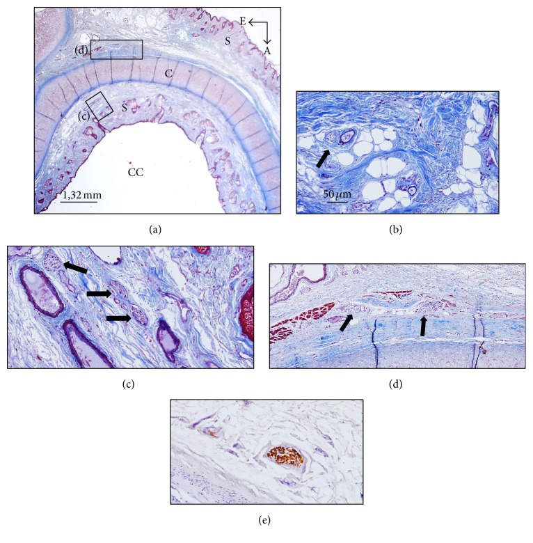 Innervation of the Human Cavum Conchae and Auditory Canal: Anatomical ...