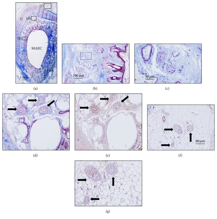 Innervation of the Human Cavum Conchae and Auditory Canal: Anatomical ...