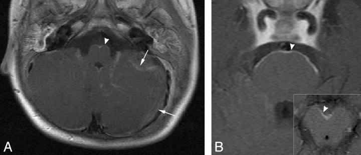 Fig 3.