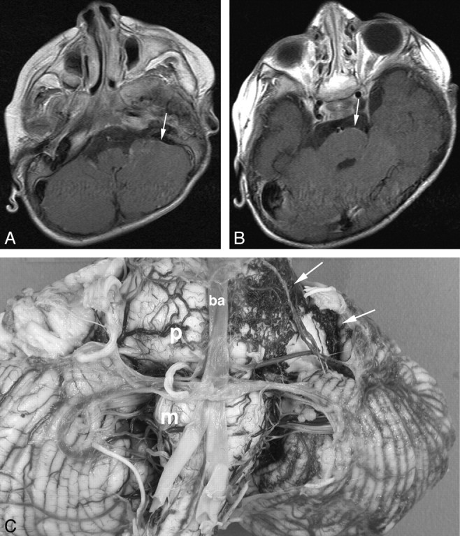 Fig 4.