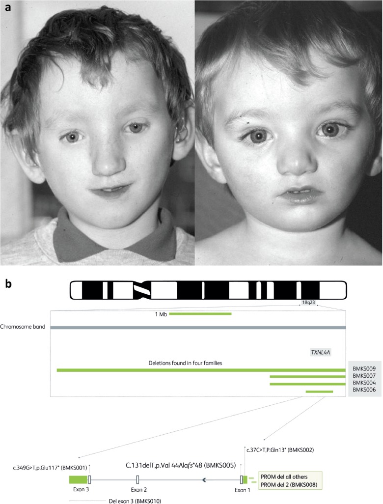 Fig 3.