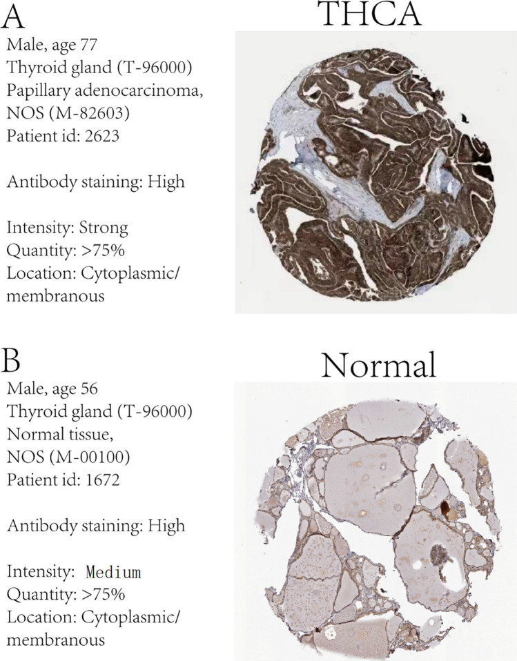 Fig. 11