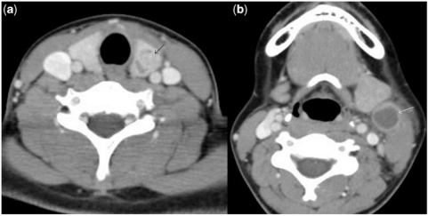 Figure 12.