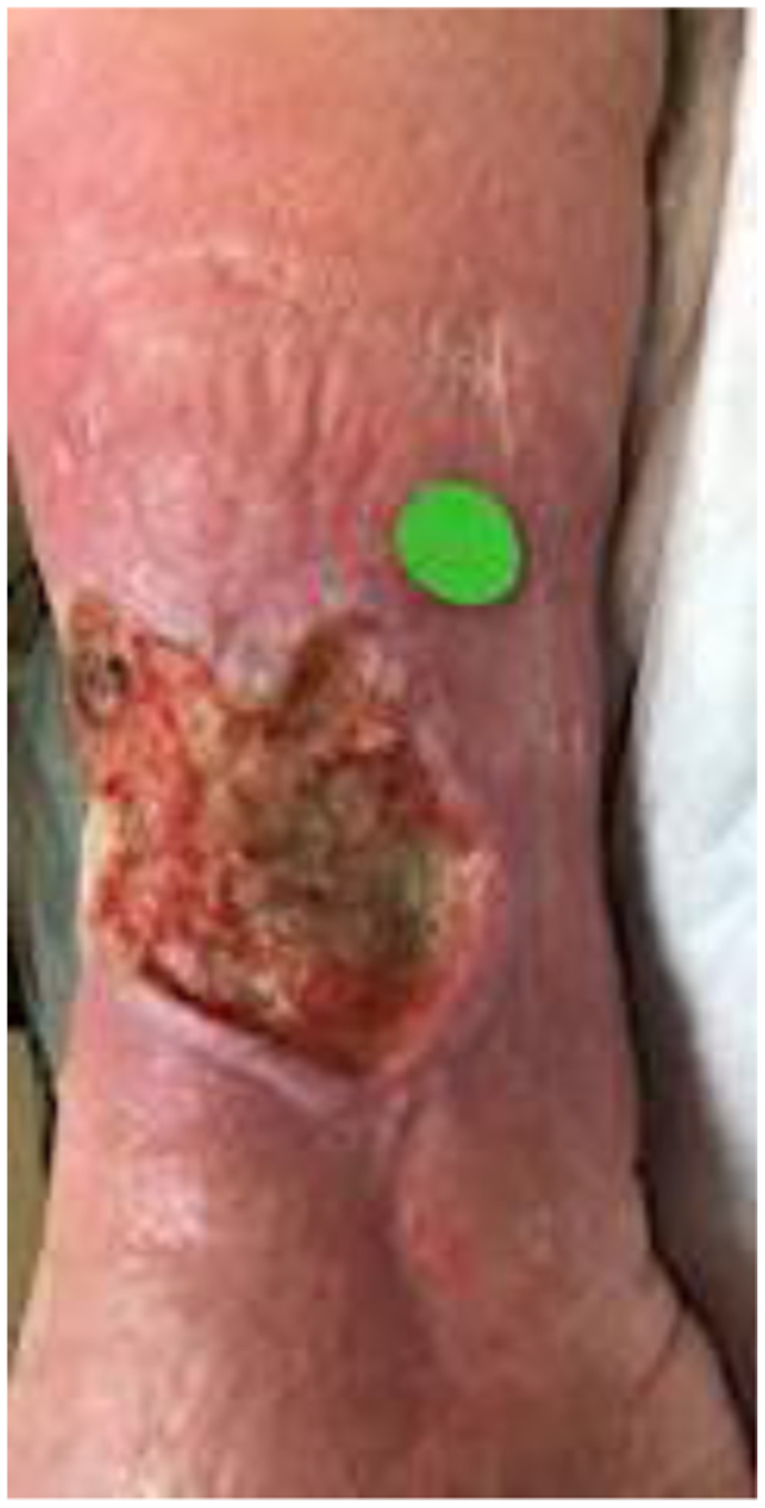 Fig 4