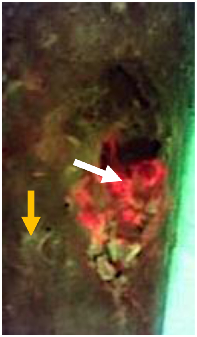 Fig 3