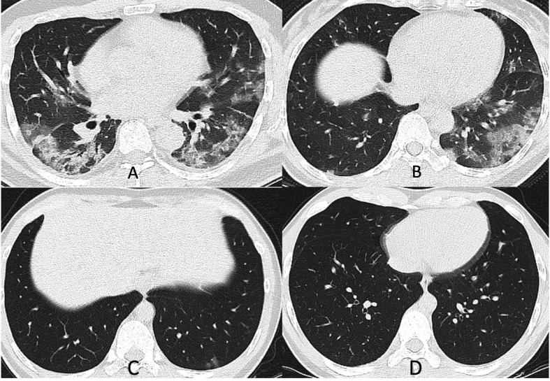 Fig. 1