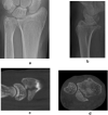 Fig. 17