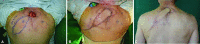 Fig
