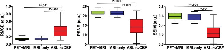 Graphs show image quality metrics of relative cerebral blood flow change (rΔCBF) maps from PET-plus-MRI model, MRI-only model, and rΔCBF measured with multidelay arterial spine labeling (ASL rΔCBF) compared with reference PET. (a) Patients with Moyamoya disease. (b) Healthy control participants. In patients with Moyamoya disease, both deep learning models were better than was ASL rΔCBF on all three metrics. In healthy control participants, PET-plus-MRI model was better than was ASL rΔCBF in all three metrics, while MRI-only model was only better than was ASL rΔCBF for structural similarity index (SSIM). There was no difference between two models in all metrics in both patients with Moyamoya disease and healthy control participants. PSNR = peak signal-to-noise ratio, RMSE = root mean square error.