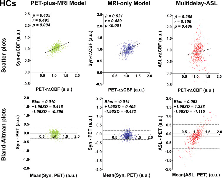 Graphs show correlation and Bland-Altman plots of relative cerebral blood flow change (rΔCBF) from both deep learning models and rΔCBF measured with multidelay arterial spin labeling (ASL rΔCBF), compared with reference PET. (a) Patients with Moyamoya disease (MMs). In patients with Moyamoya disease, both models and ASL rΔCBF correlated with rΔCBF measured with PET (PET-rΔCBF), while correlation coefficients of both models were higher than that of ASL rΔCBF. (b) Healthy control participants (HCs). In healthy control participants, both models correlated with PET, while ASL rΔCBF does not. On Bland-Altman plots, both models showed less bias and reduced variance compared with ASL rΔCBF, which showed a proportional bias to rΔCBF values. Beta is slope of correlation and r is the correlation coefficient. SD = standard deviation, Syn = synthetic, Syn-rΔCBF = synthetic rΔCBF predicted by deep learning models.