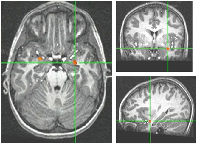 Figure 2: