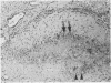 103