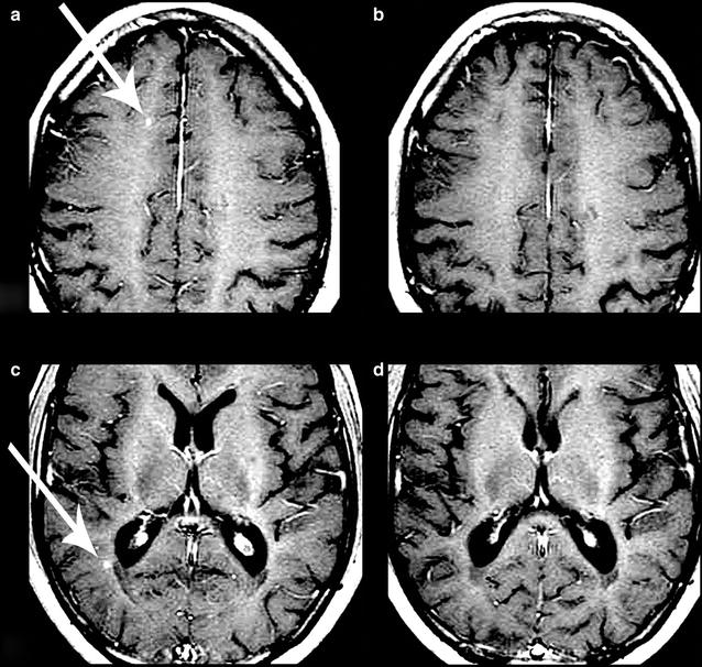 Fig. 7