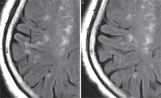 Fig 5.