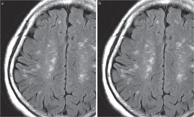 Fig 1.