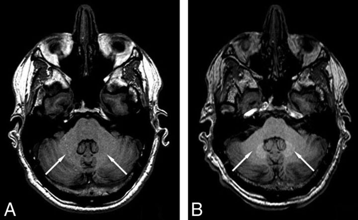 Fig 4.