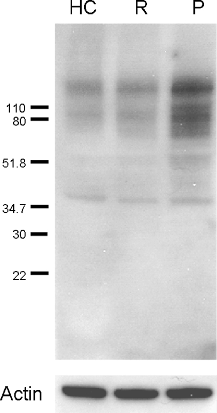 Fig. 14.