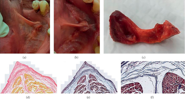 Figure 13