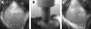 FIG. 1.