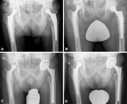 Fig. 1A–D