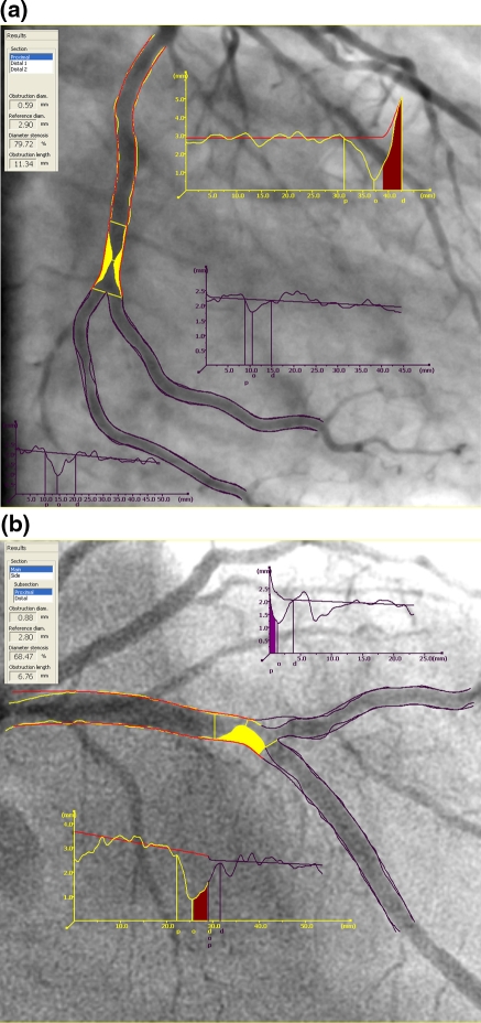 Fig. 11