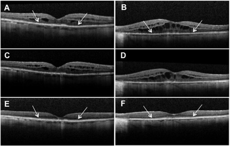 Fig. 1