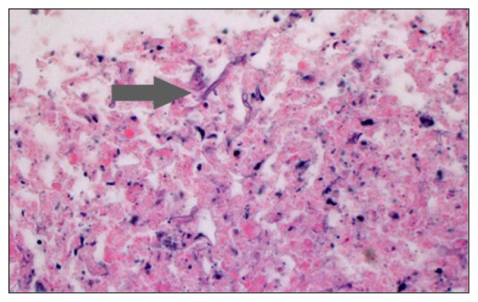 Figure 4A